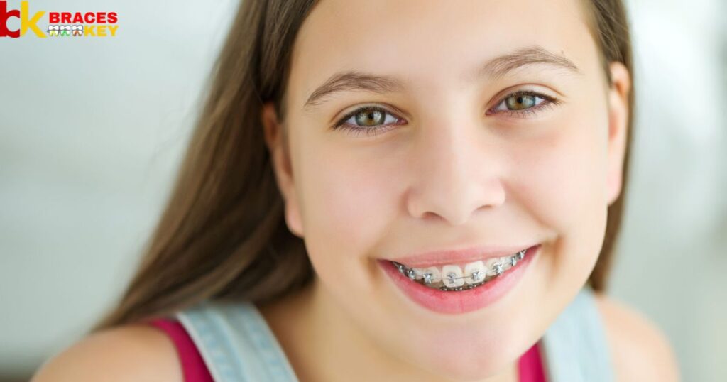 Best braces colors for girls
