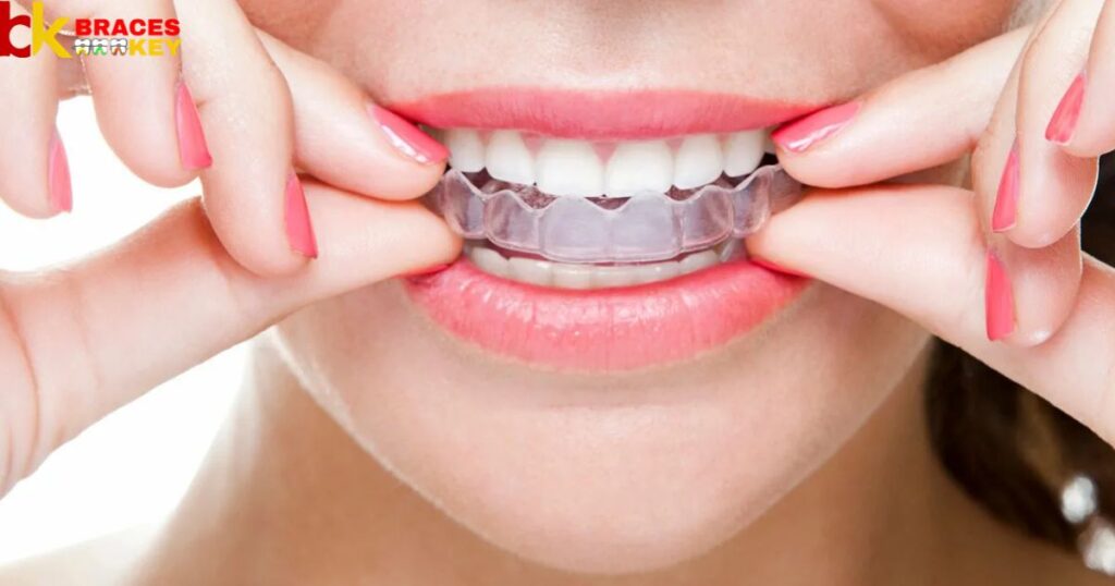 Delta dental plans that cover braces