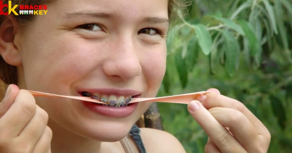 Effects of sticky and chewy candy on braces