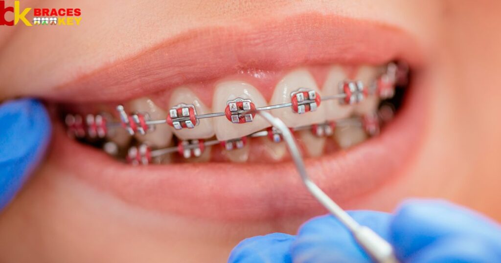 Factors to consider when deciding to cut braces wires