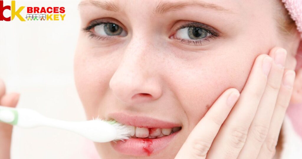 Gum Disease and Tooth Decay