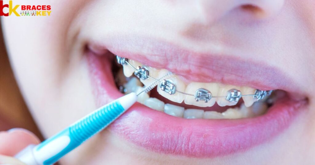 Fix a loose wire in braces
