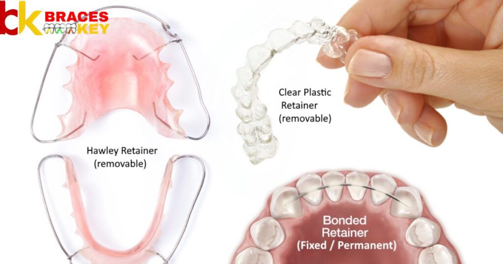What types of removable retainers are there