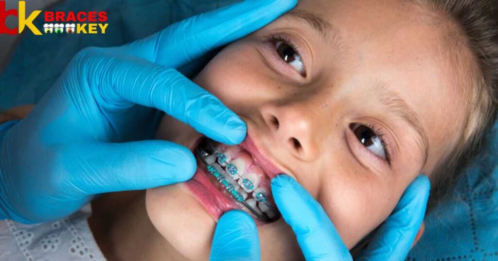 Contrast On A Child's Fake Teeth On Braces