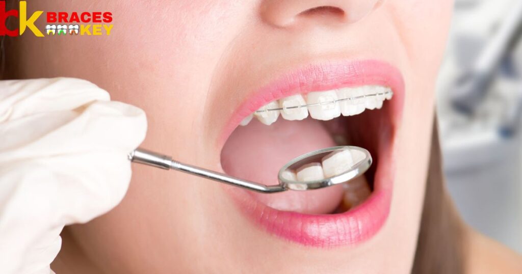 A Dentist Clean Teeth With Braces