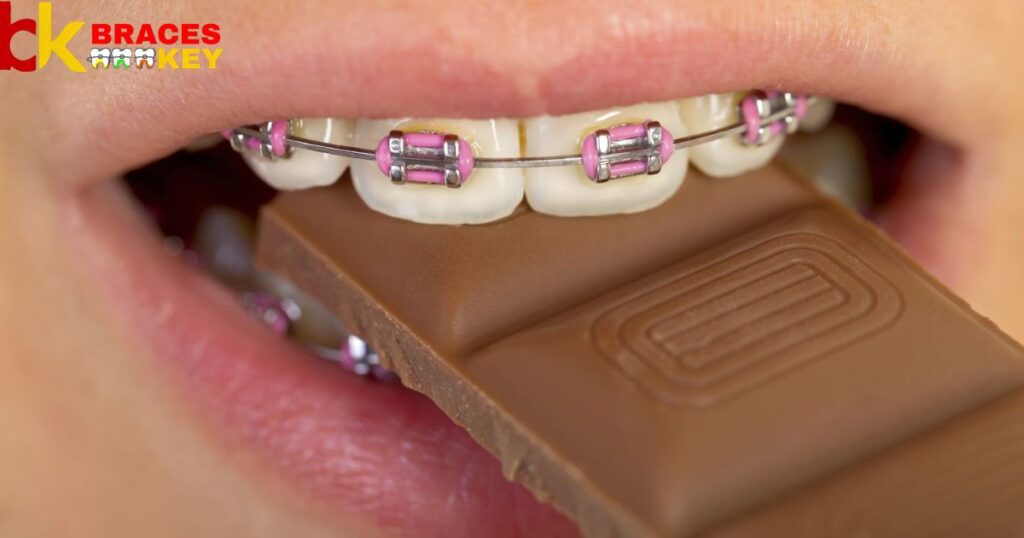 Balancing your sweet cravings while wearing braces