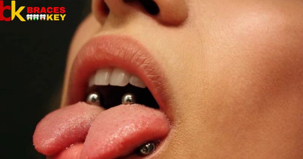 Braces And Tongue Piercing