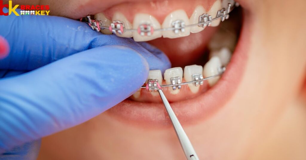 Unlocking Your Braces-Free Potential