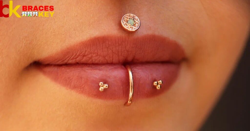 Get A Labret Piercing With Braces