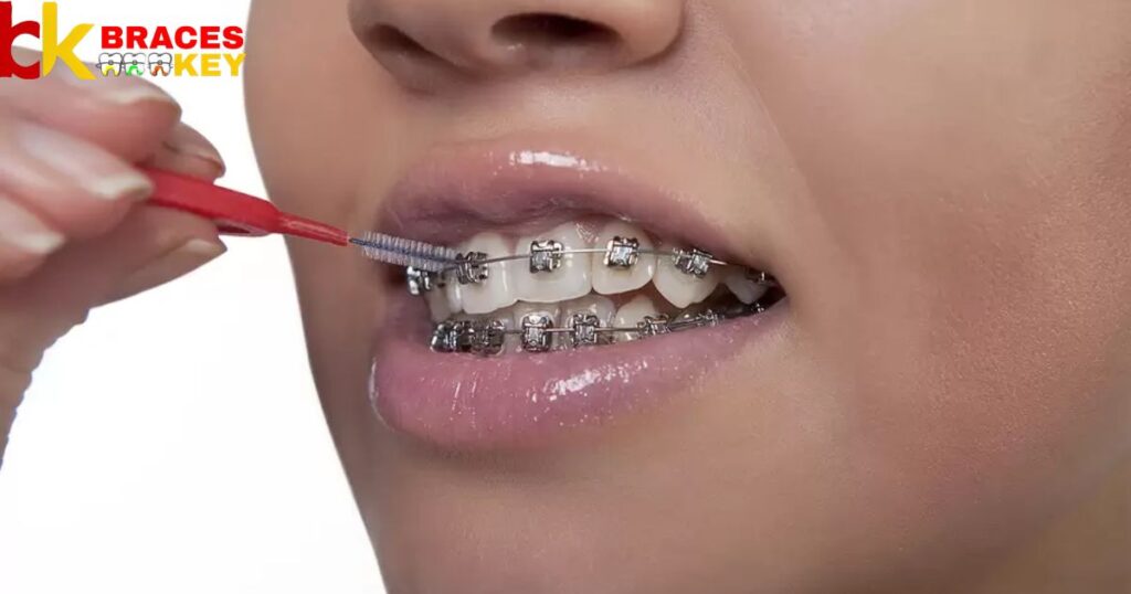 Get A Tooth Removed With Braces
