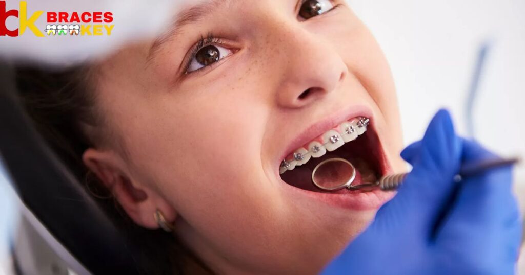 Get Braces Teeth With Baby Left Teeth