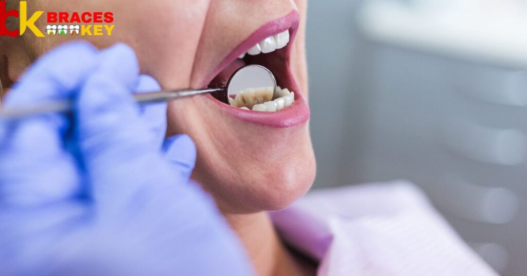 Preventing Future Dental Mishaps