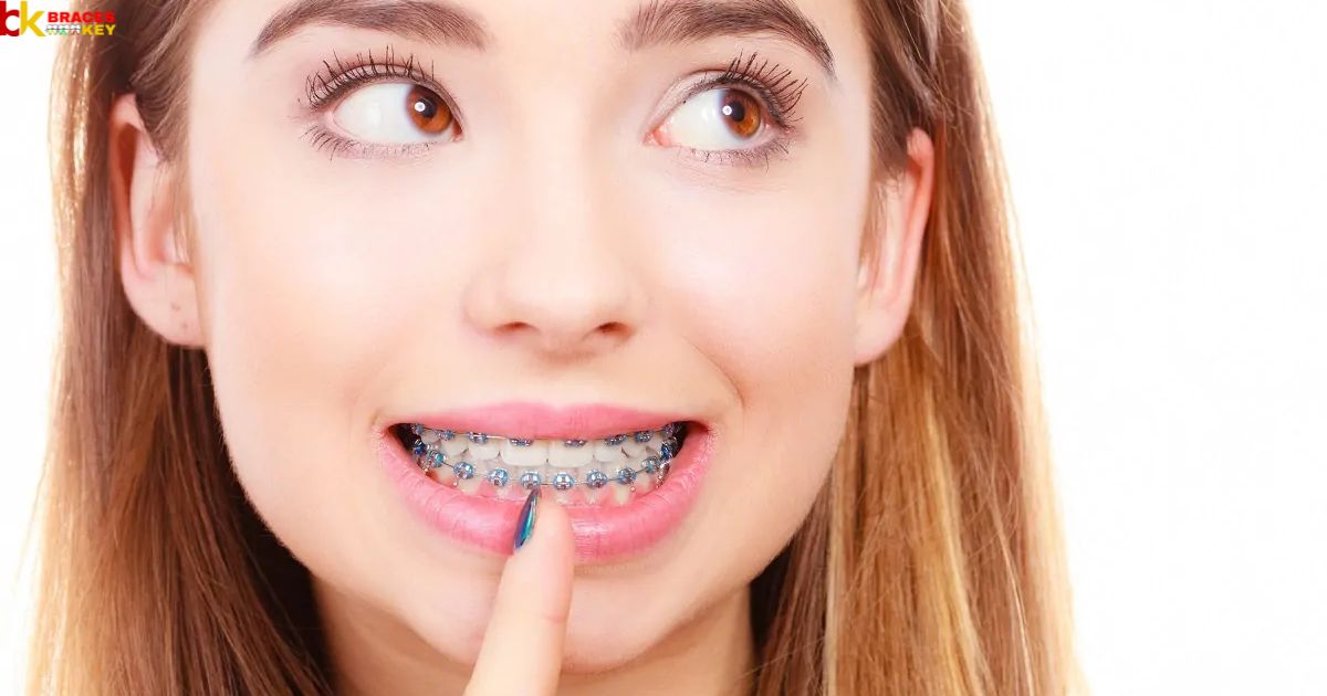 Assessing the Tightness of Your Braces