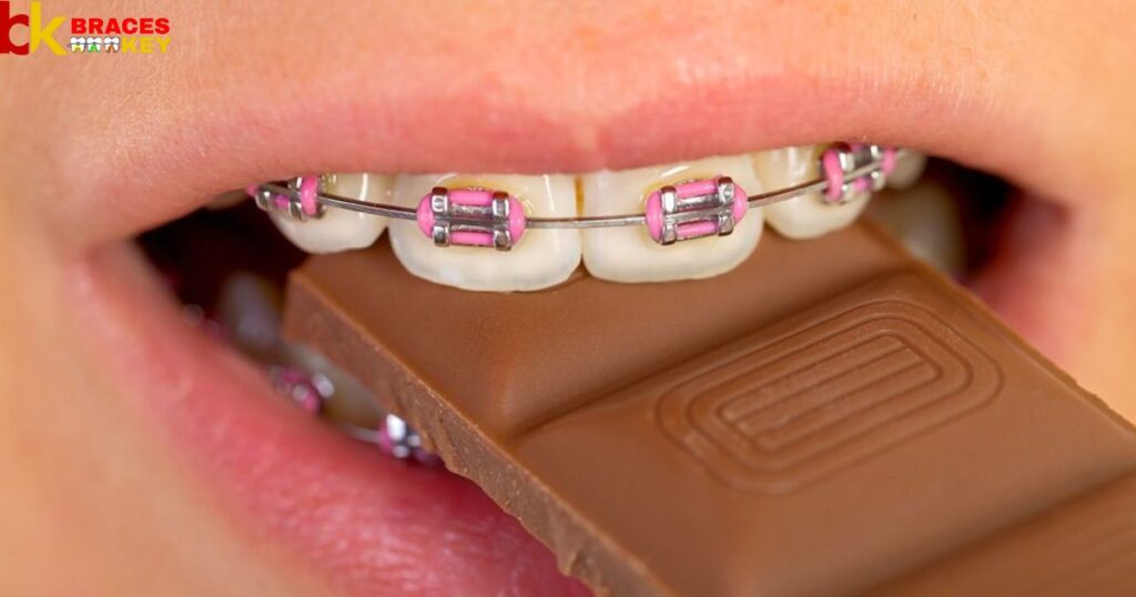 Candy Can You Eat With Braces Not Chocolate