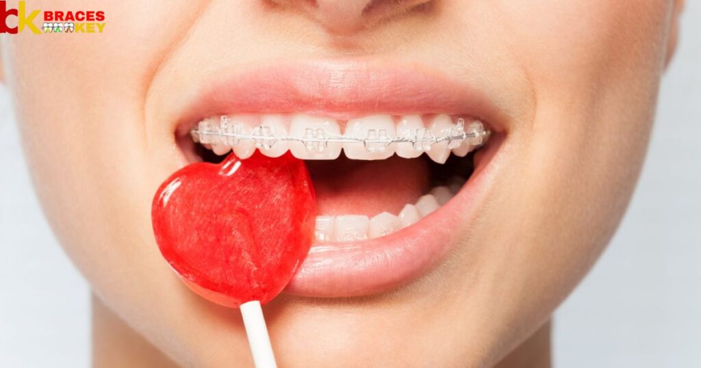 Candy To Avoid With Braces