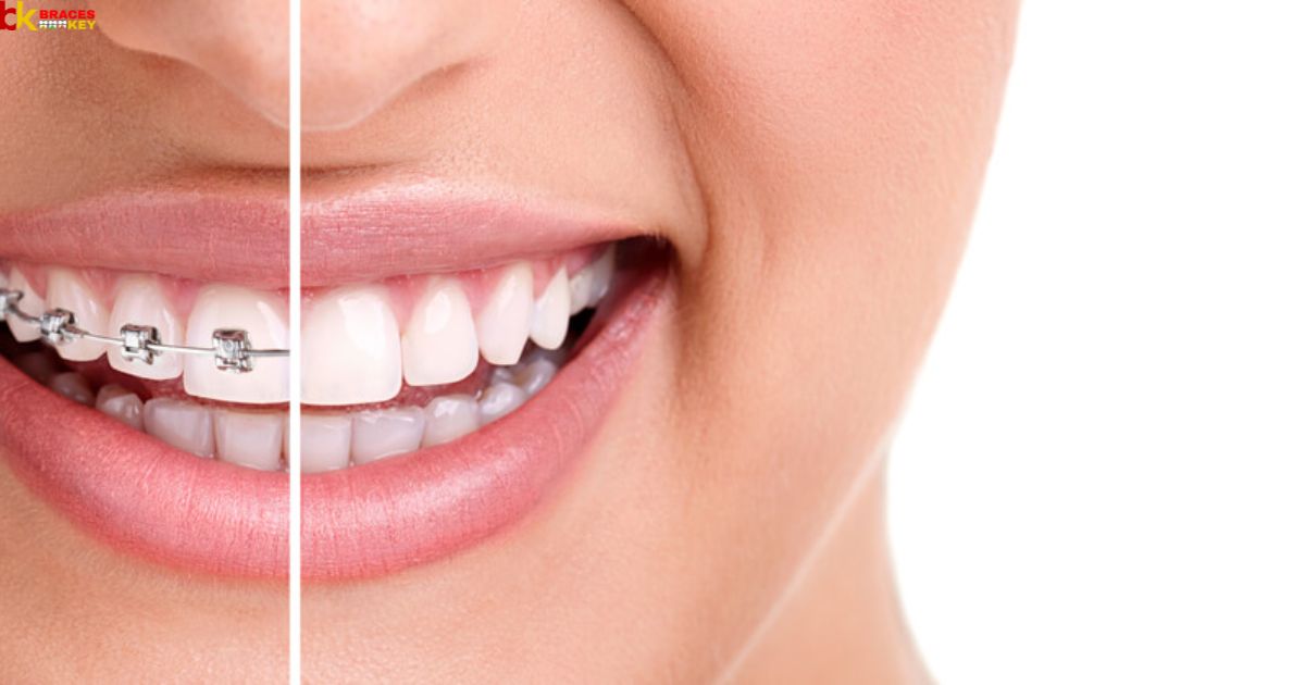Importance of an Orthodontic Consultation