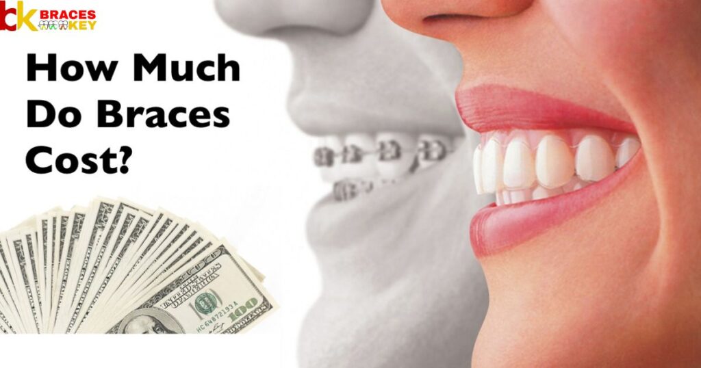 Overview Of Braces Cost In Mexico