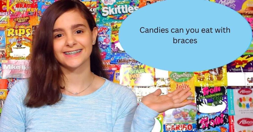 Overview Of Candies Can You Eat With Braces