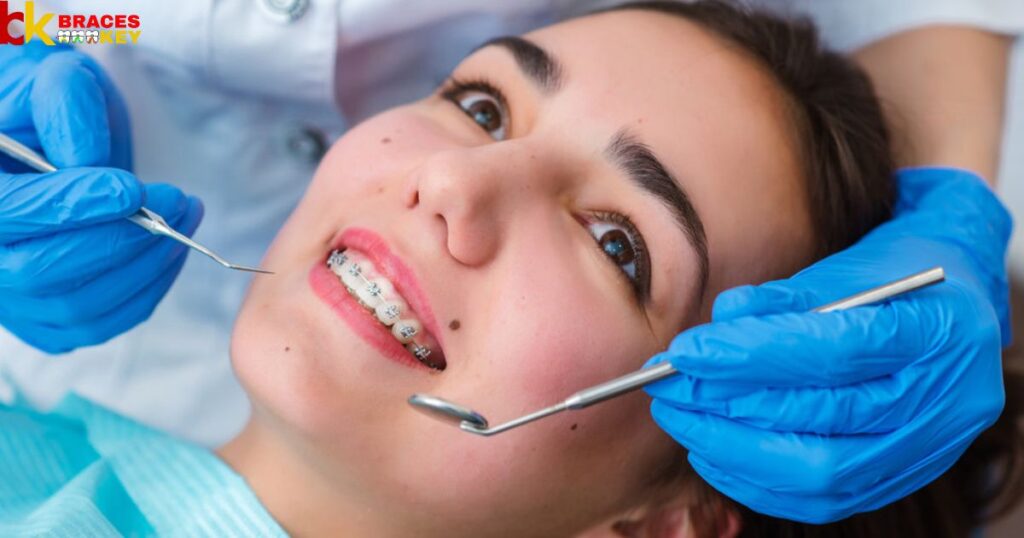 Overview Of Getting Braces Glue Off Teeth