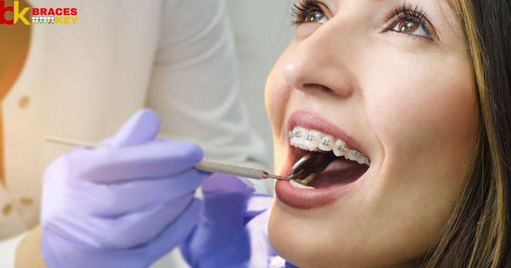 Overview Of Many Appointments Before Getting Braces