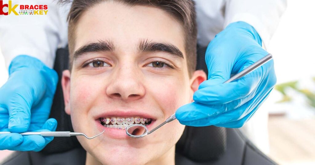 Take To Put Braces On The First Time
