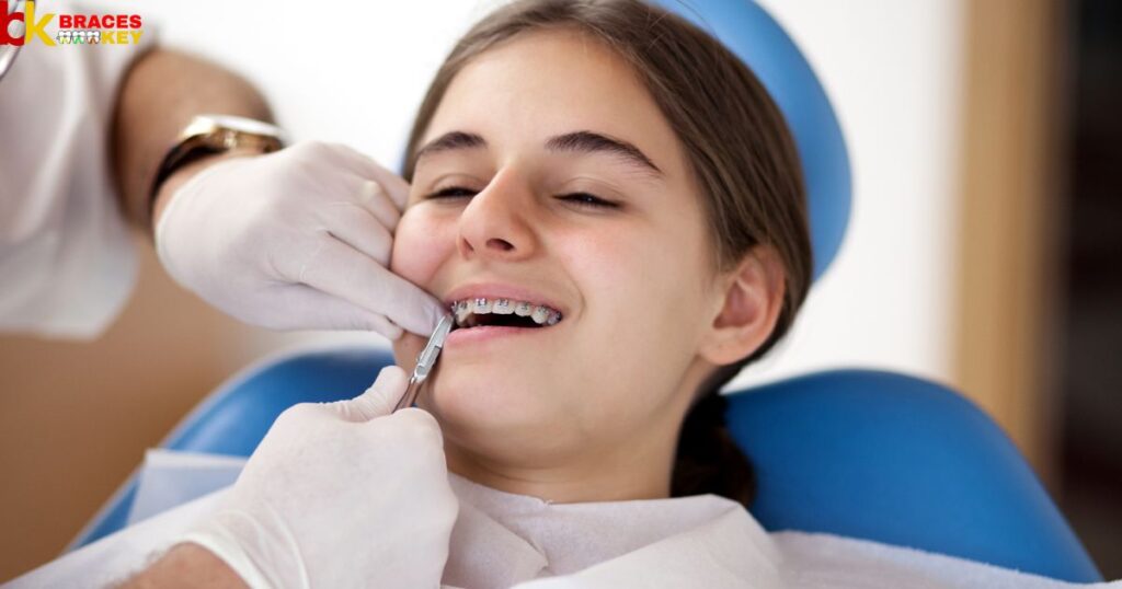 A Dentist Remove Braces Glue