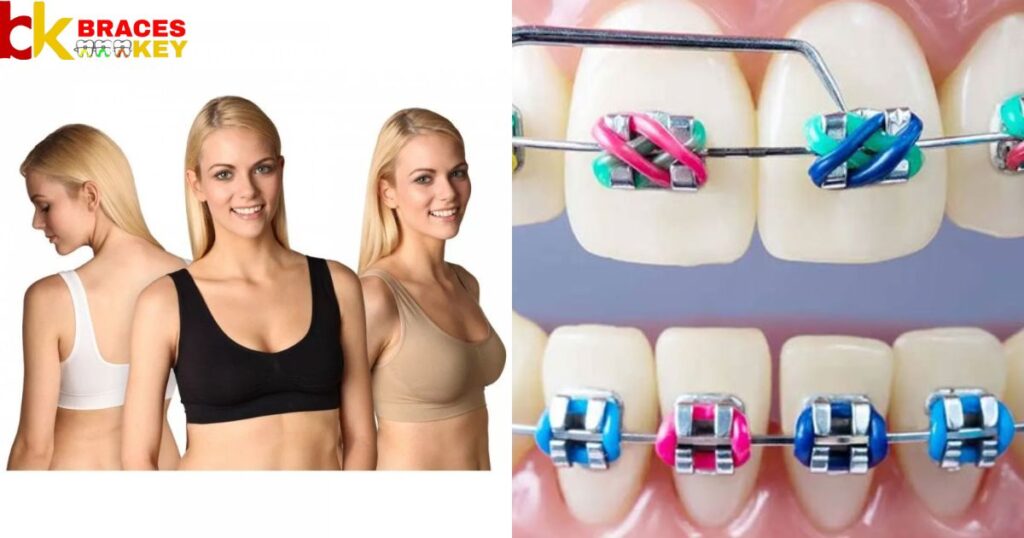 Braces Band Colors And Your Skin Tone