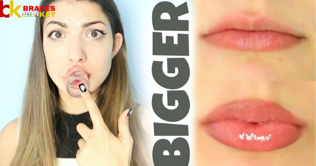 Can Braces Make Your Lips Look Bigger
