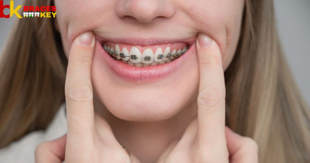 Effects Of Braces On Oral Sensitivity