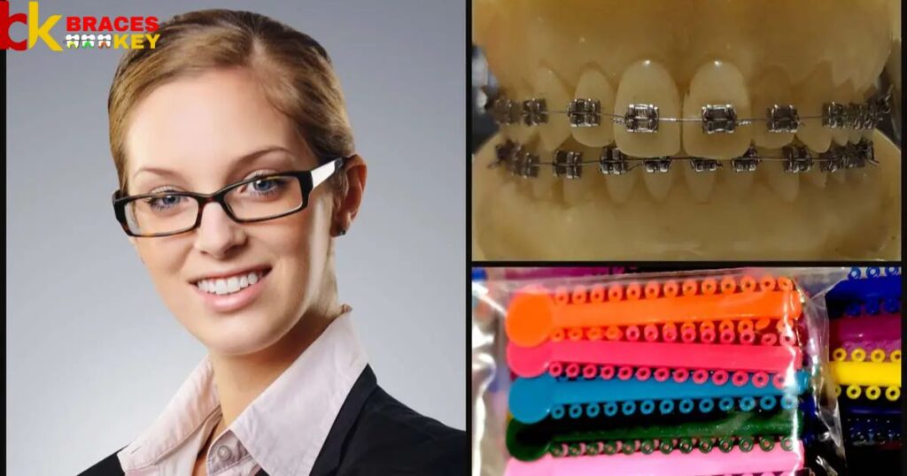 Here Are Some Tips On Choosing The Right Color For Your Braces