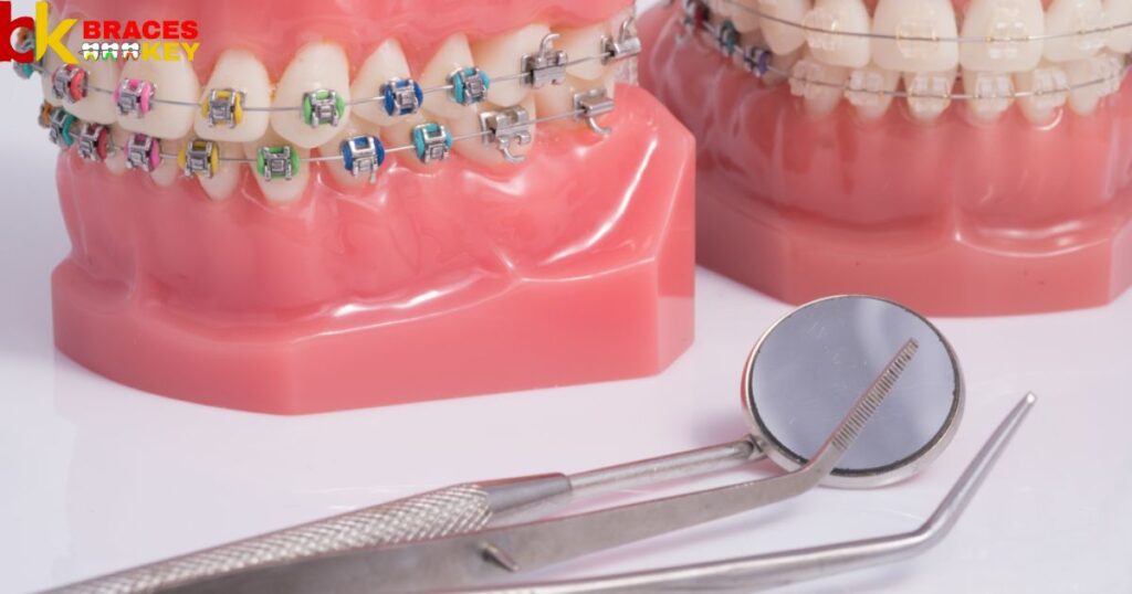 How Can I Make My Orthodontic Treatment More Affordable