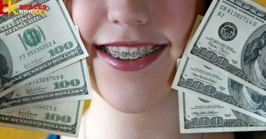 How Much Do Braces Cost For Adults