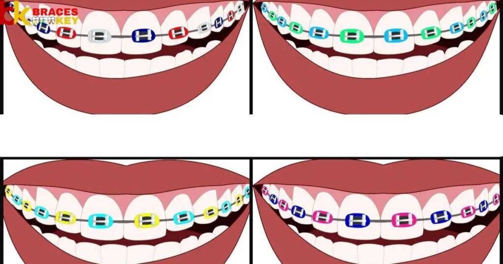 How To Choose The Best Braces Colors To Brighten Your Smile