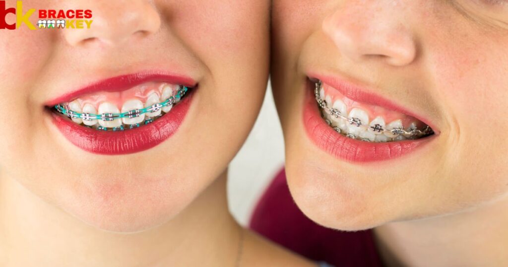 Maintaining Teal Braces