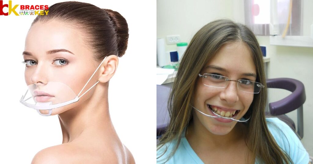 Orthodontic Headgear Before And After
