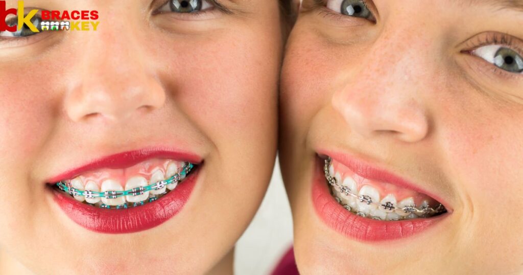 Overview Of Braces In NC