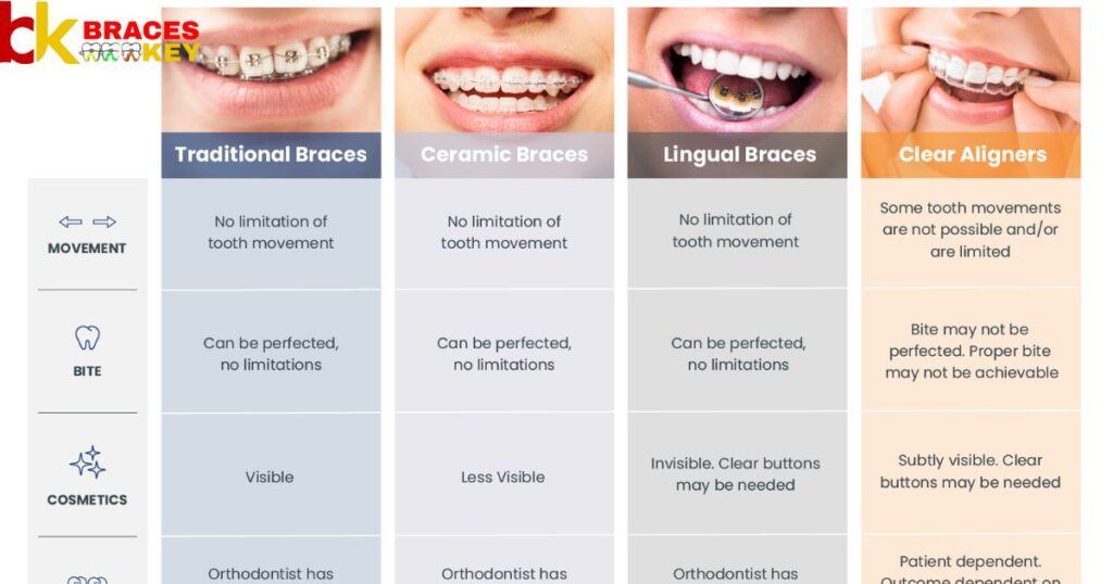Overview Of Braces Wire Sizes & Types