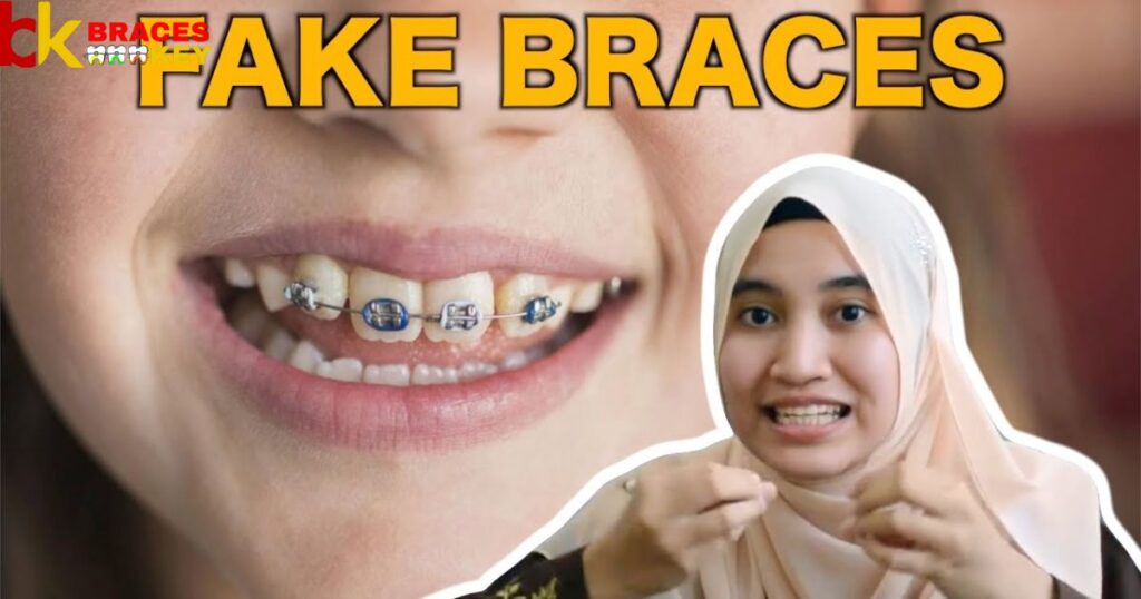 Overview Of Buy Fake Braces