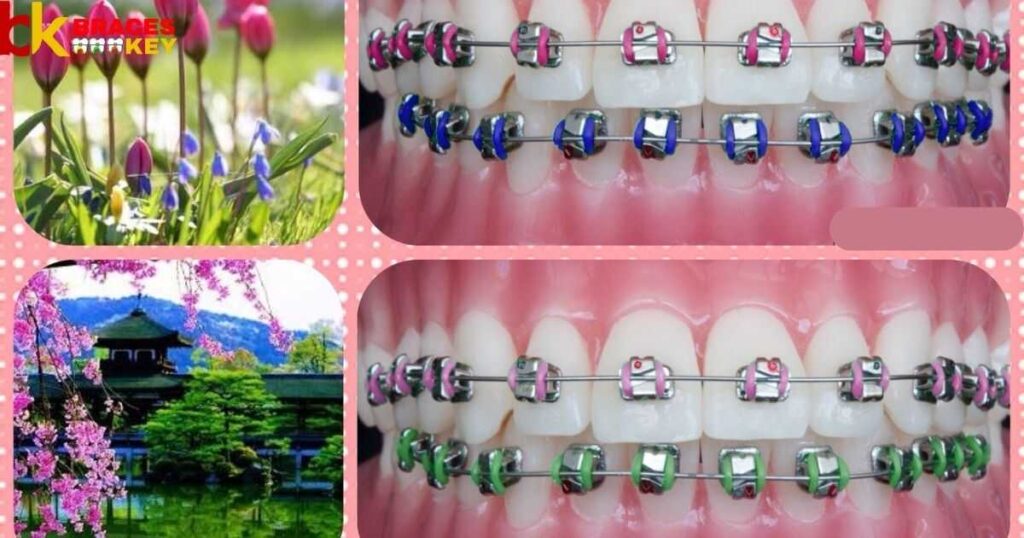 Overview Of Flattering Braces Colors For You