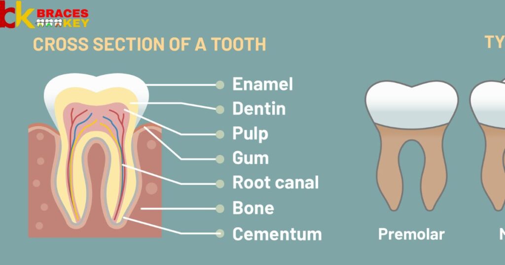 Overview Of Molar Bands Necessary