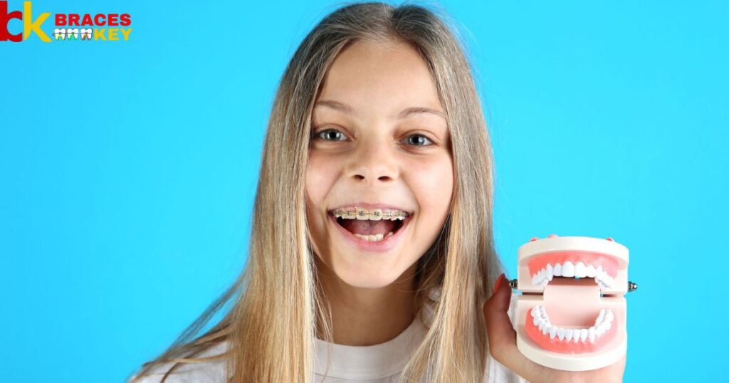 Overview Of People Need Braces