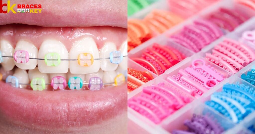 Overview Of The Best Braces Colors