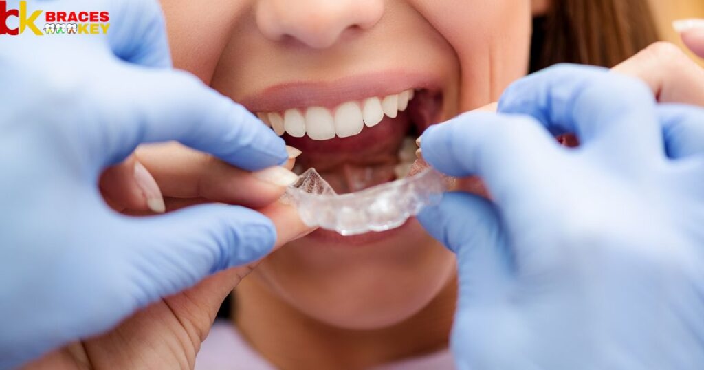 Overview Of Use Your Old Retainer To Re Straighten Your Teeth