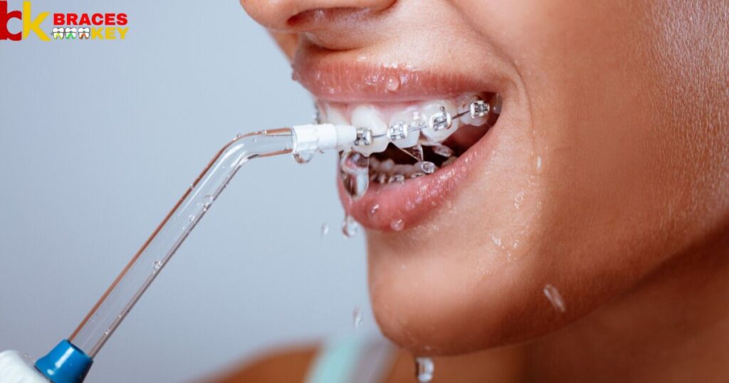 Overview Of Waterpik With Braces