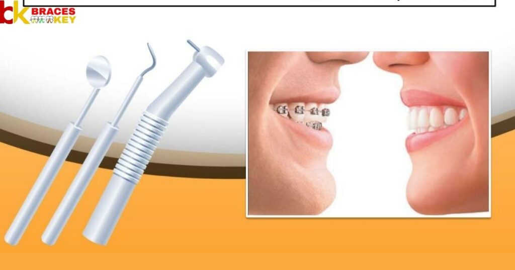 Teeth Straightening Or Alignment Process
