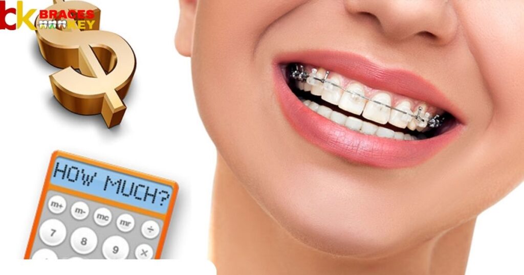 Teeth That Need Braces Cost