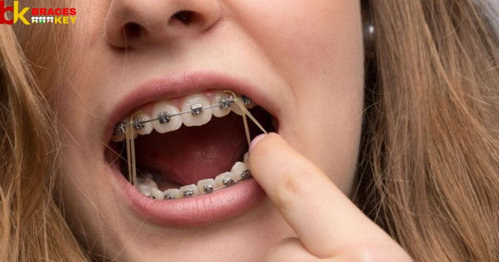 To manage rubber bands and braces pain