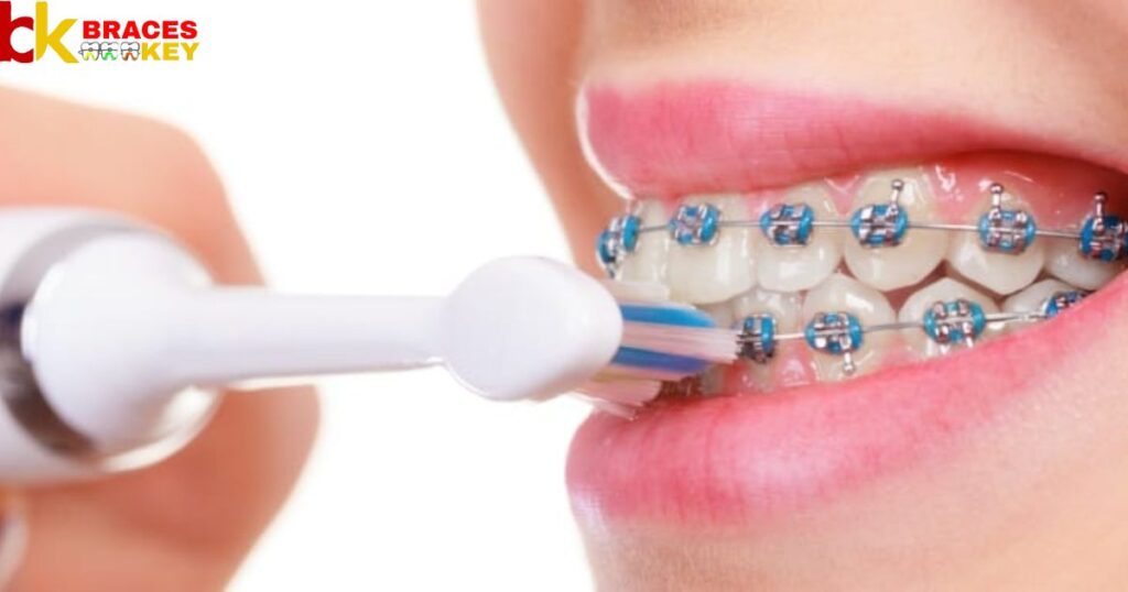 Using An Electric Toothbrush With Braces