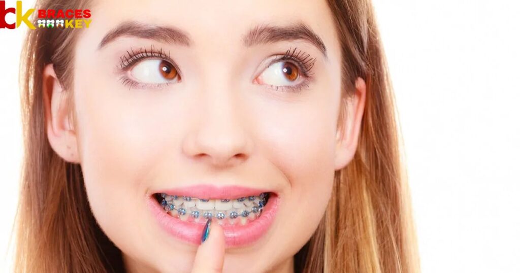 What Affects The Cost Of Your Braces