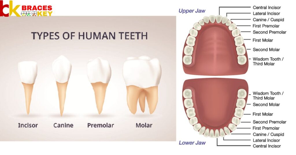 What Are The Advantages Of Molar Bands